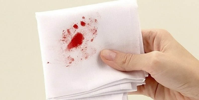 Viêm xoang khạc ra máu: Mức độ nguy hiểm và cách chữa trị