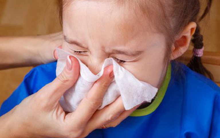 Viêm xoang ở trẻ em là bệnh lý về đường hô hấp thường xảy ra ở trẻ dưới 6 tuổi